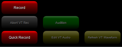5. Voice Tracking 
Buttons